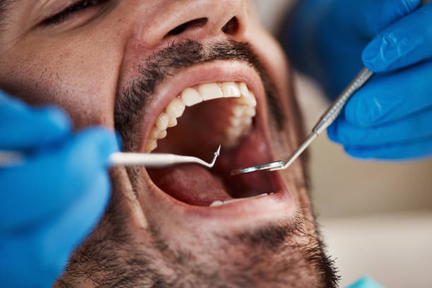 Emergency Dental Services in Langley, WA